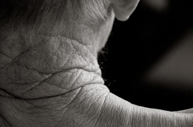 Fotos do corpo após os 100 anos