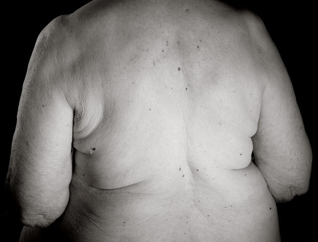 Fotos do corpo após os 100 anos